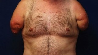 FILES-GERMANY-HEALTH-OPERATION-TRANSPLANT