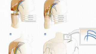 transplante_brazos_02