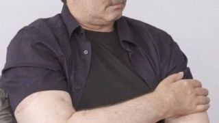 transplante_brazos_07