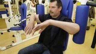 transplante_brazos_10